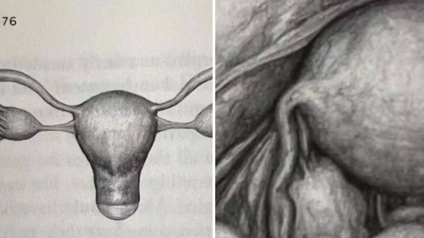 People only just realising what female pelvic anatomy actually looks like and they’re not impressed
