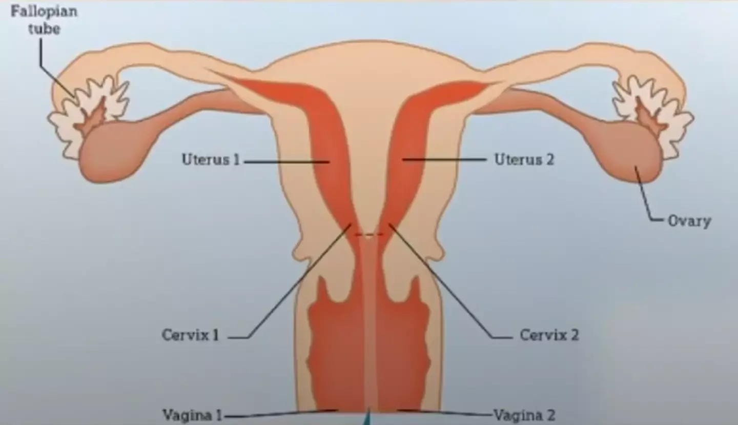 Evelyn has two wombs, two uteruses and two vaginas.