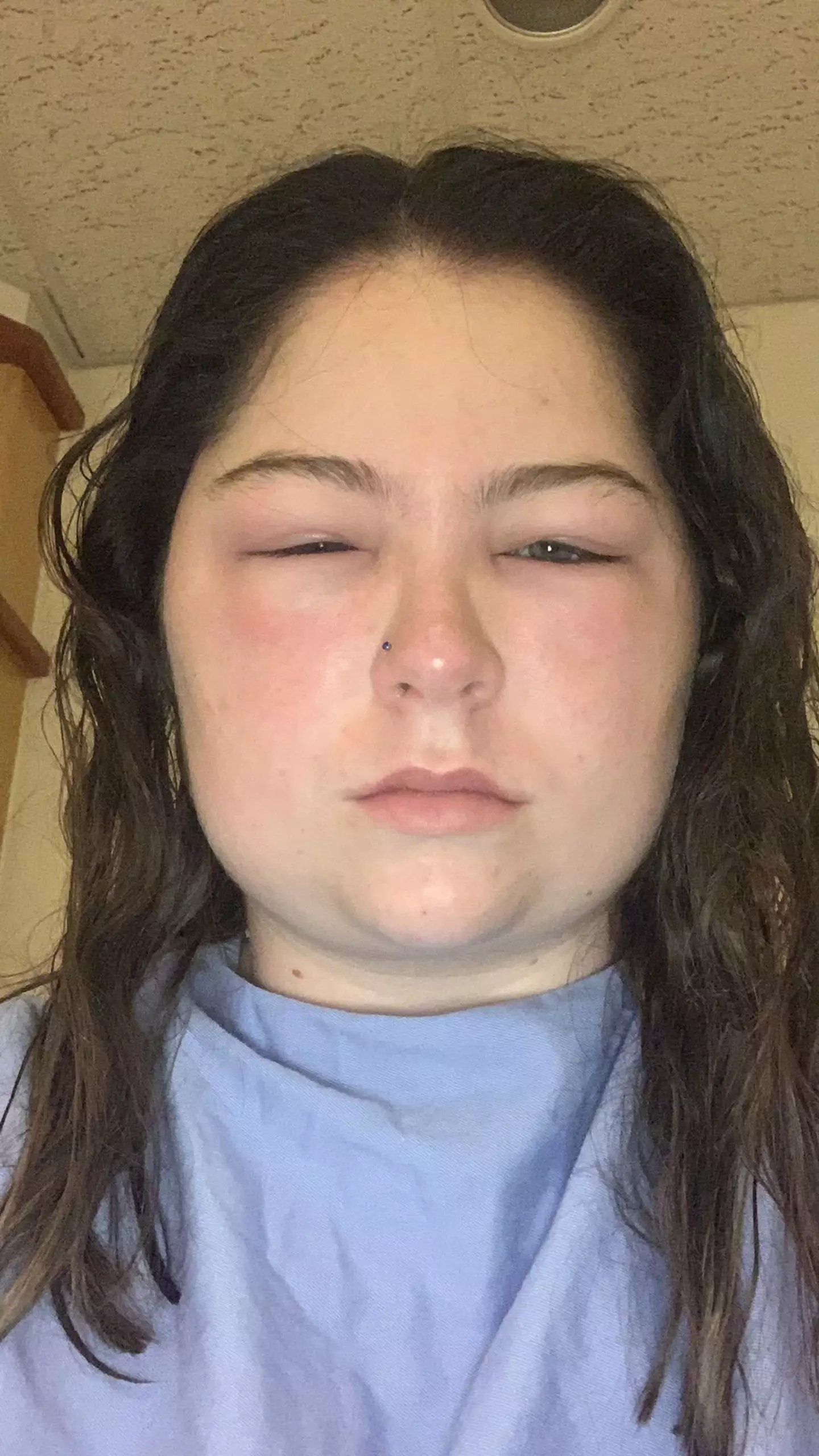 A woman says she almost died after an allergic reaction to hair dye.