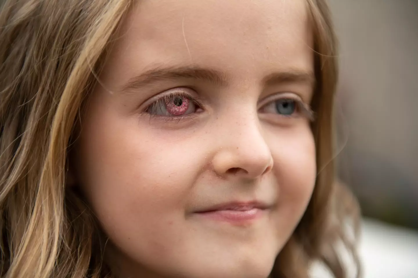 Daisy has a brand new prosthetic eye.