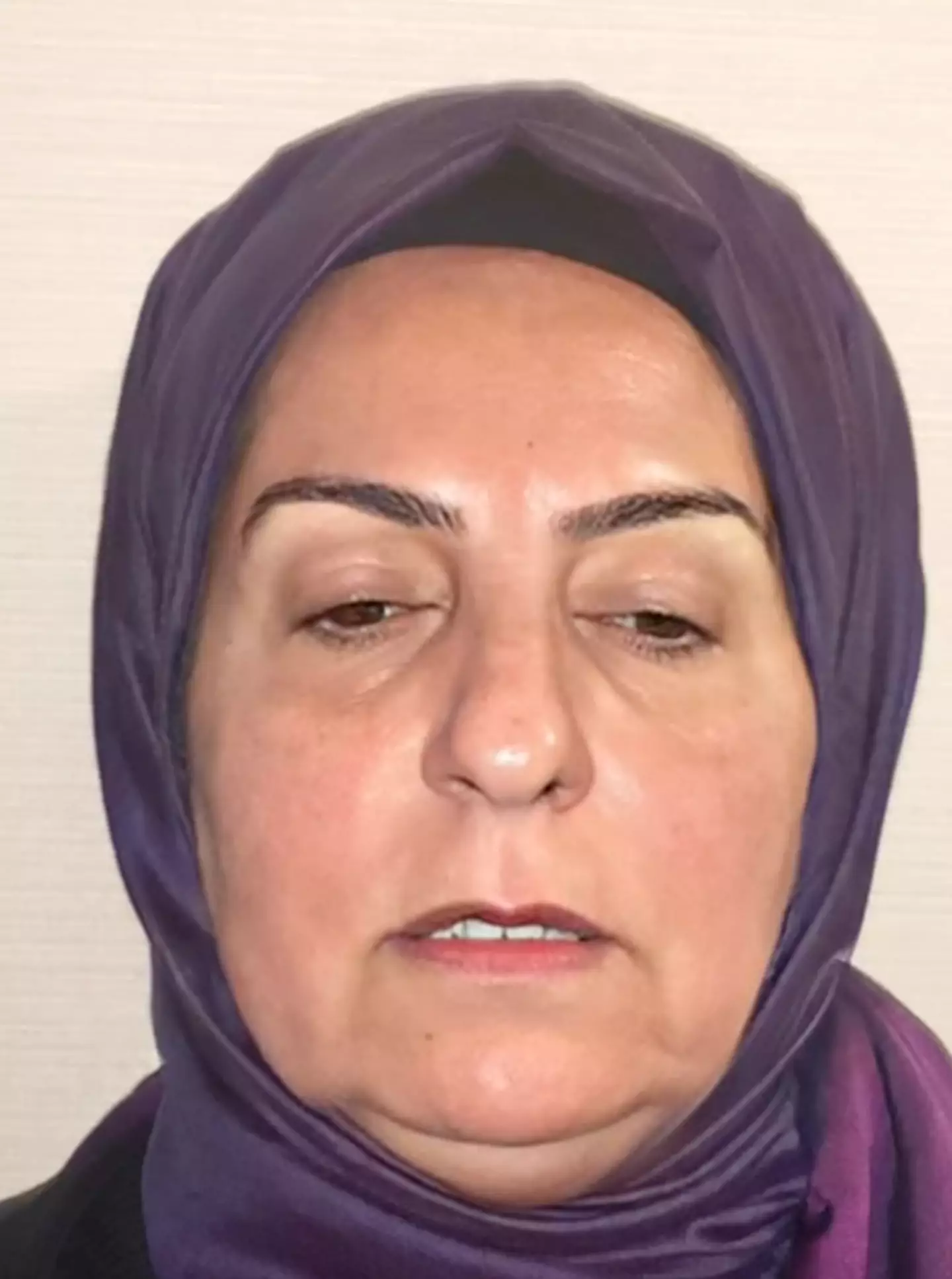 The internets' minds have been blown by the 'insane' before and after cosmetic surgery transformation.