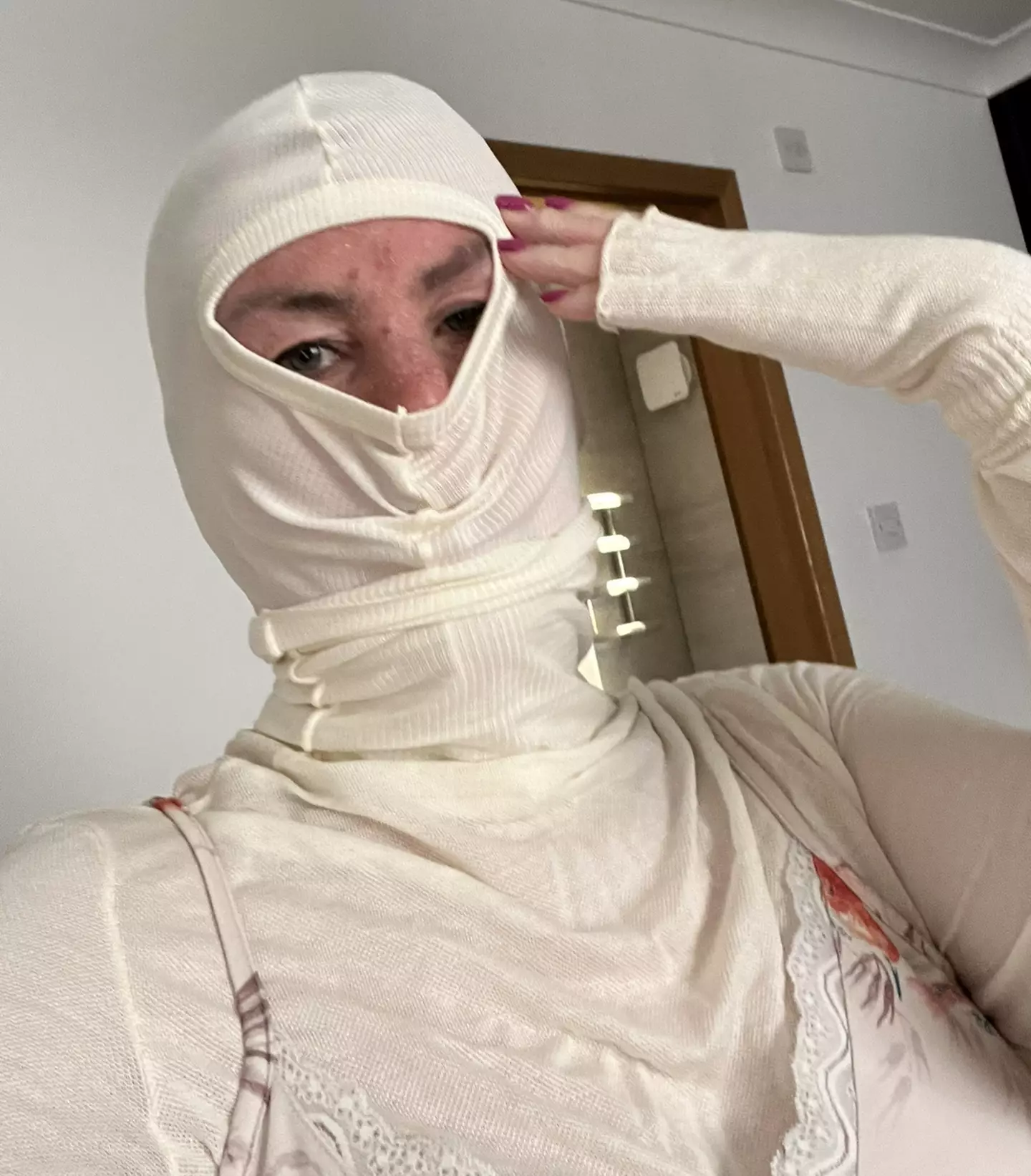 Flett would resort to wearing a balaclava and full upper-body bandages to ease the itching.
