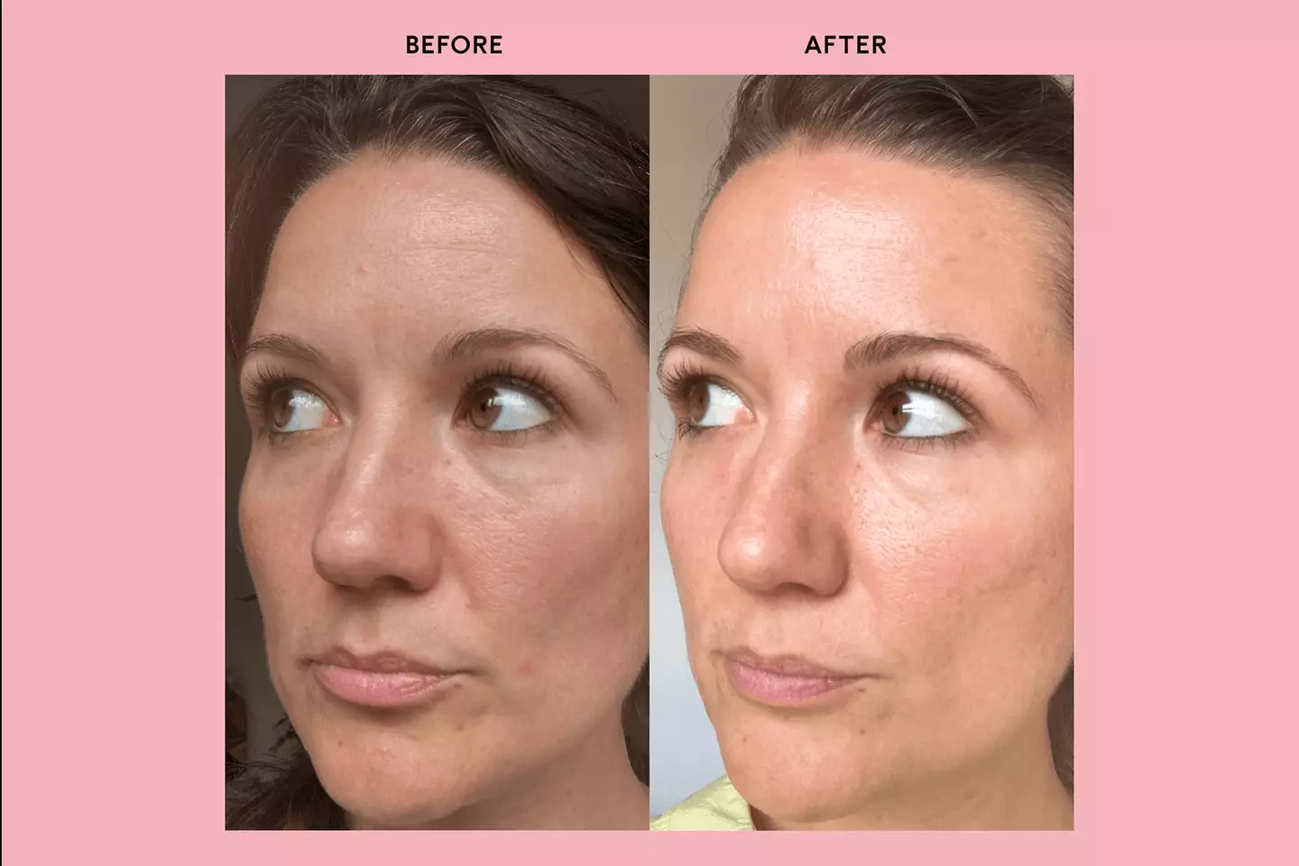 People have said the food supplement left their skin feeling 'plumped' (Feel)