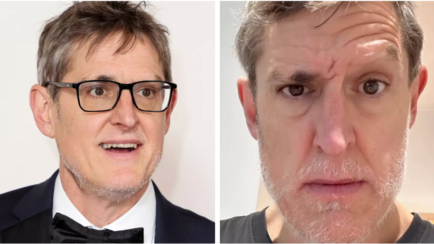 Louis Theroux says he's losing his eyebrows as he shares alopecia struggle