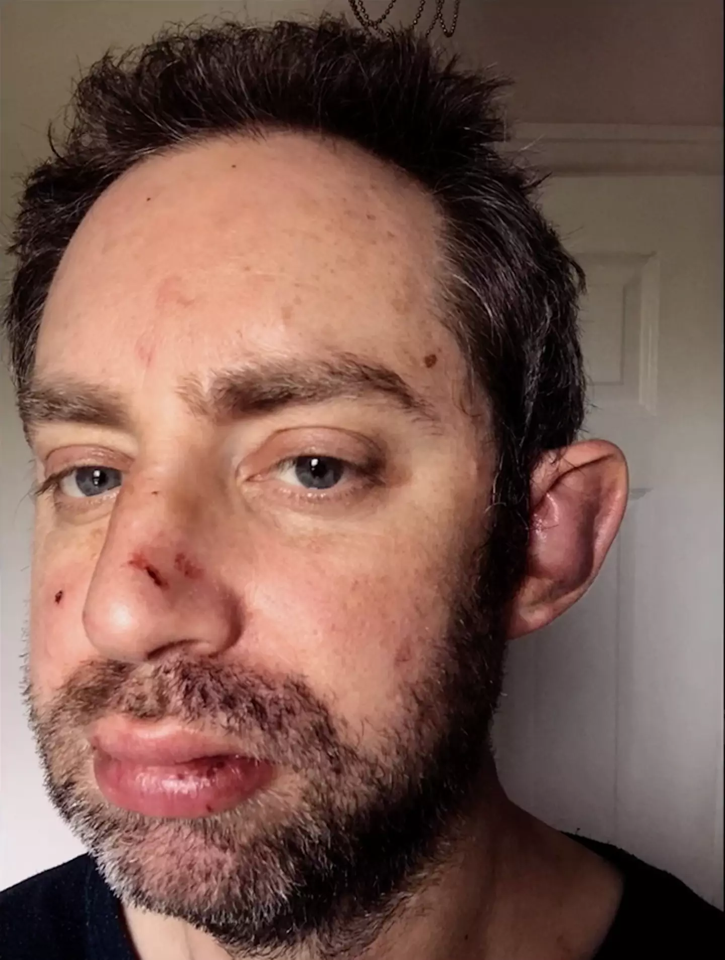 Richard began documenting the physical abuse he endured.