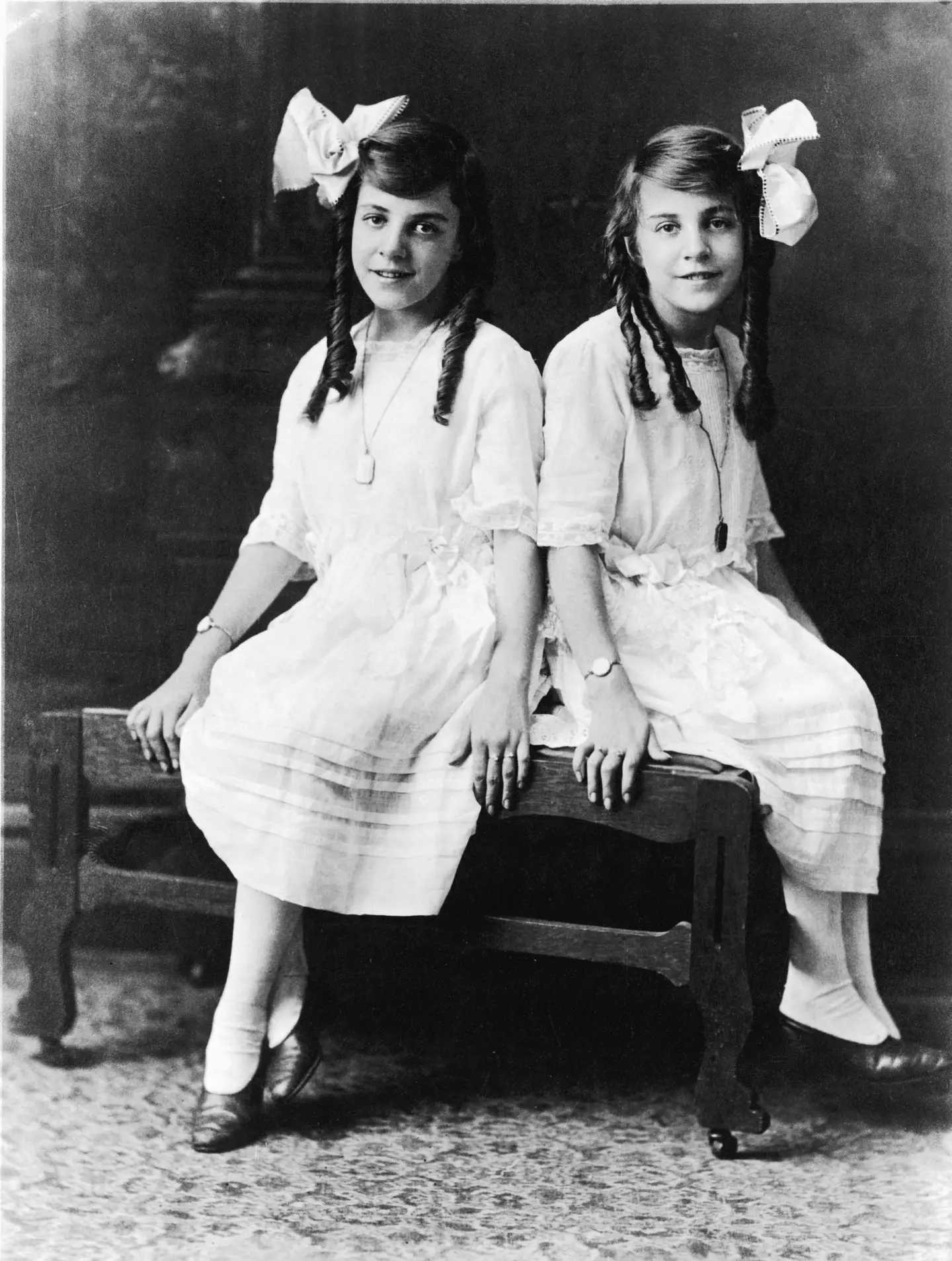 Daisy and Violet Hilton we born joined at the hip (Universal History Archive/Universal Images Group via Getty Images)