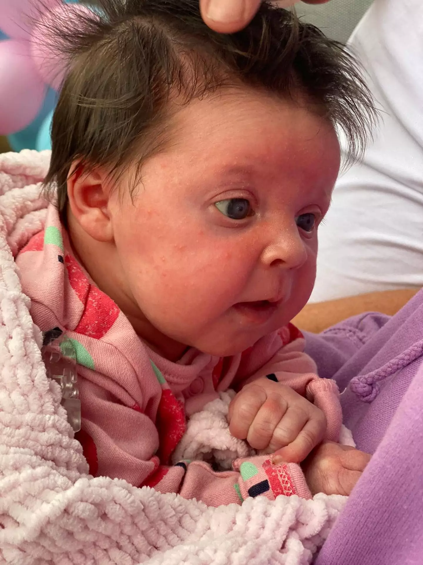 Even medical staff were shocked by Hallie's hair.