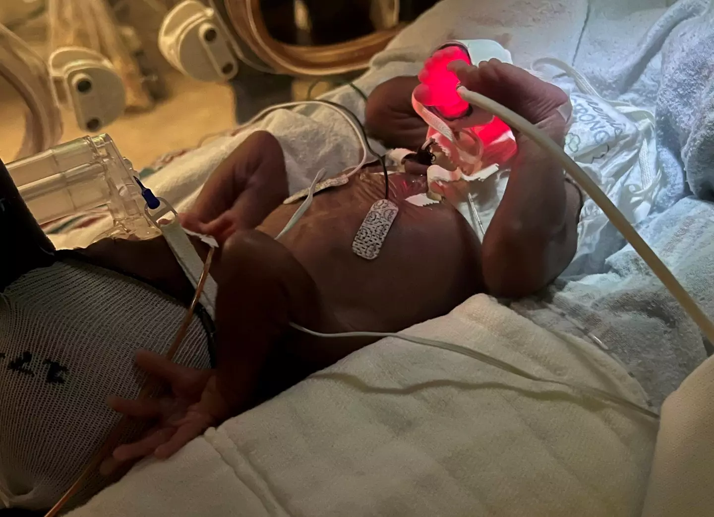 Saniah's son was born 14 weeks earlier than expected.