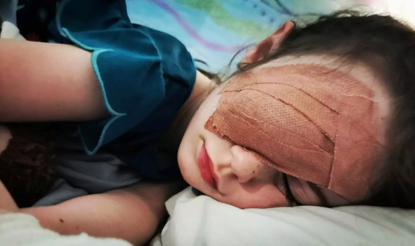 The brave youngster had to have an operation to remove her eye.