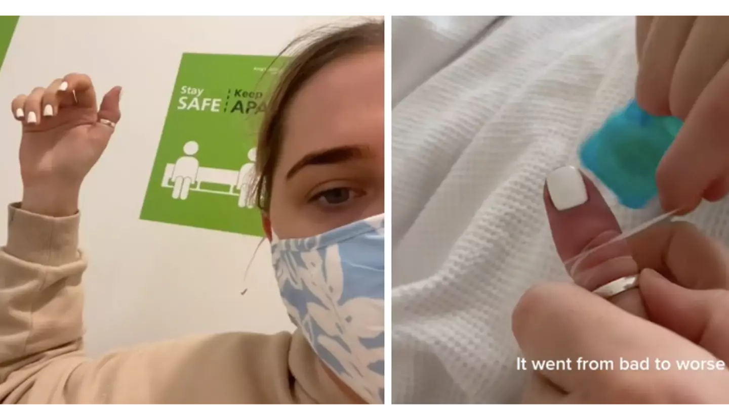 TikTok User Breaks Thumb After Sleeping With A Ring On