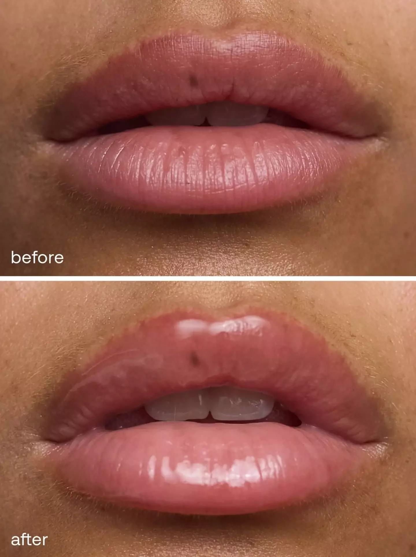 Available in two shades, they give the lips a hydrated and fuller-looking appearance.