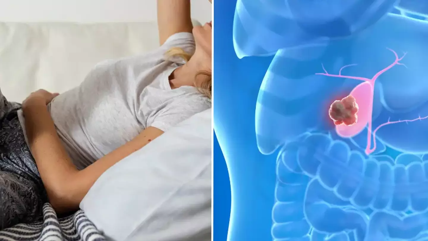 Oncologist reveals little-known cancer is surging in young people for one concerning reason