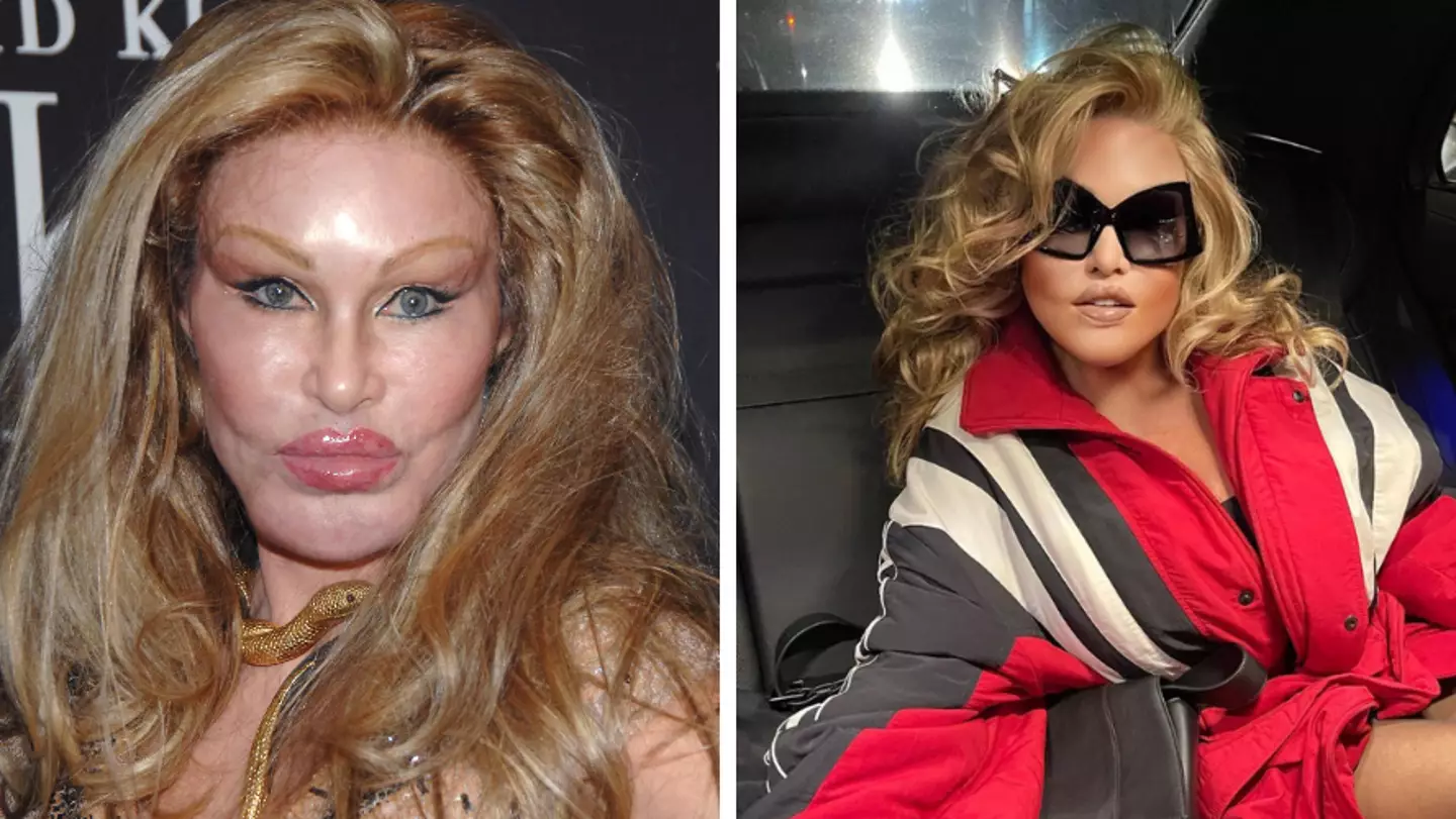 ‘Catwoman’ Jocelyn Wildenstein, 82, leaves fans stunned after posting age-defying photos
