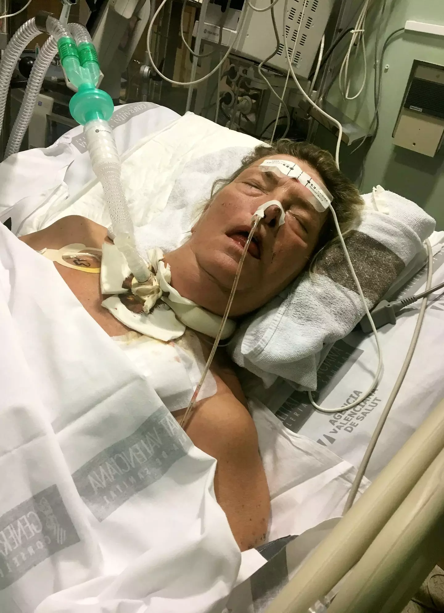 Kim was in a coma for nine weeks.