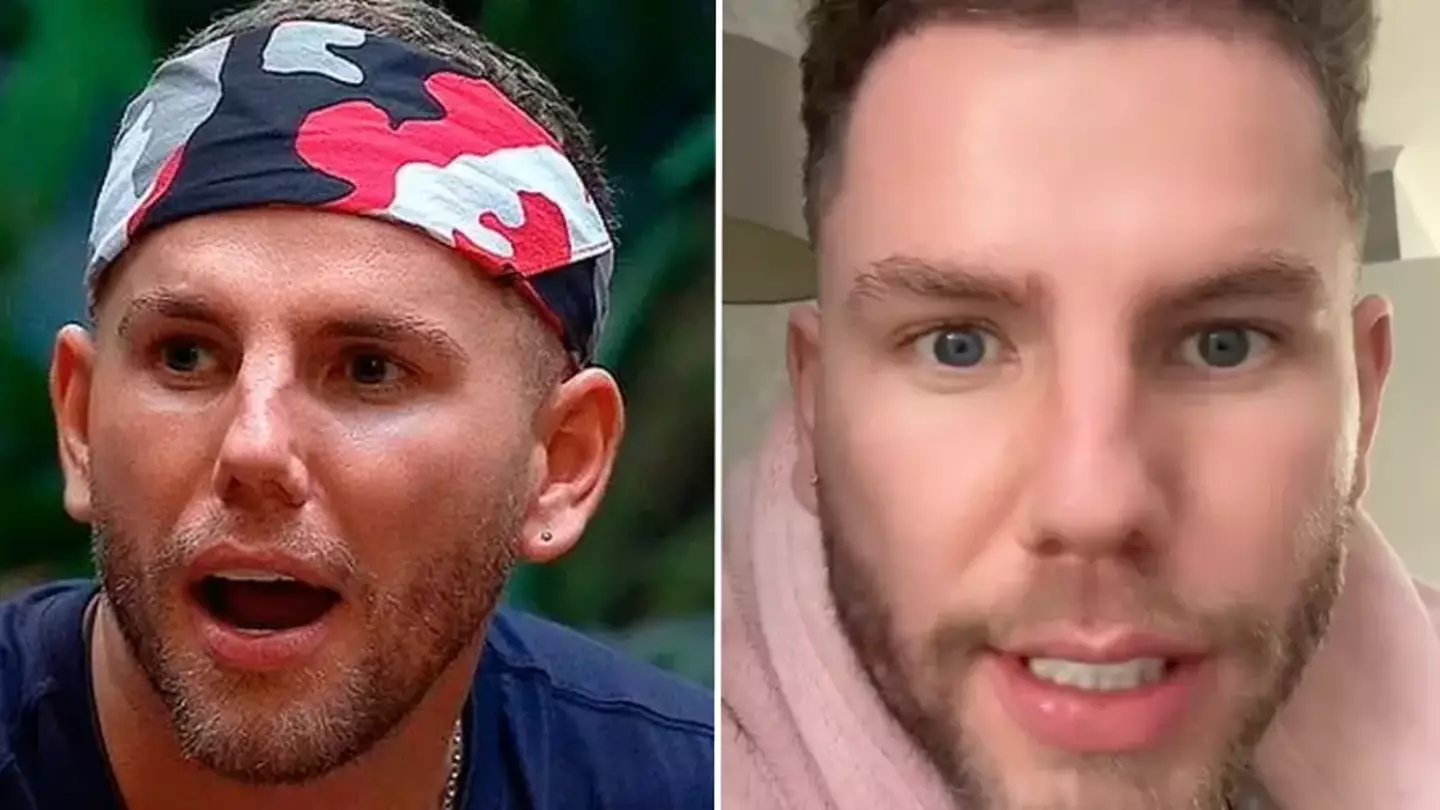 I’m A Celeb’s Dean McCullough addresses plastic surgery comments after revealing what he’s had done
