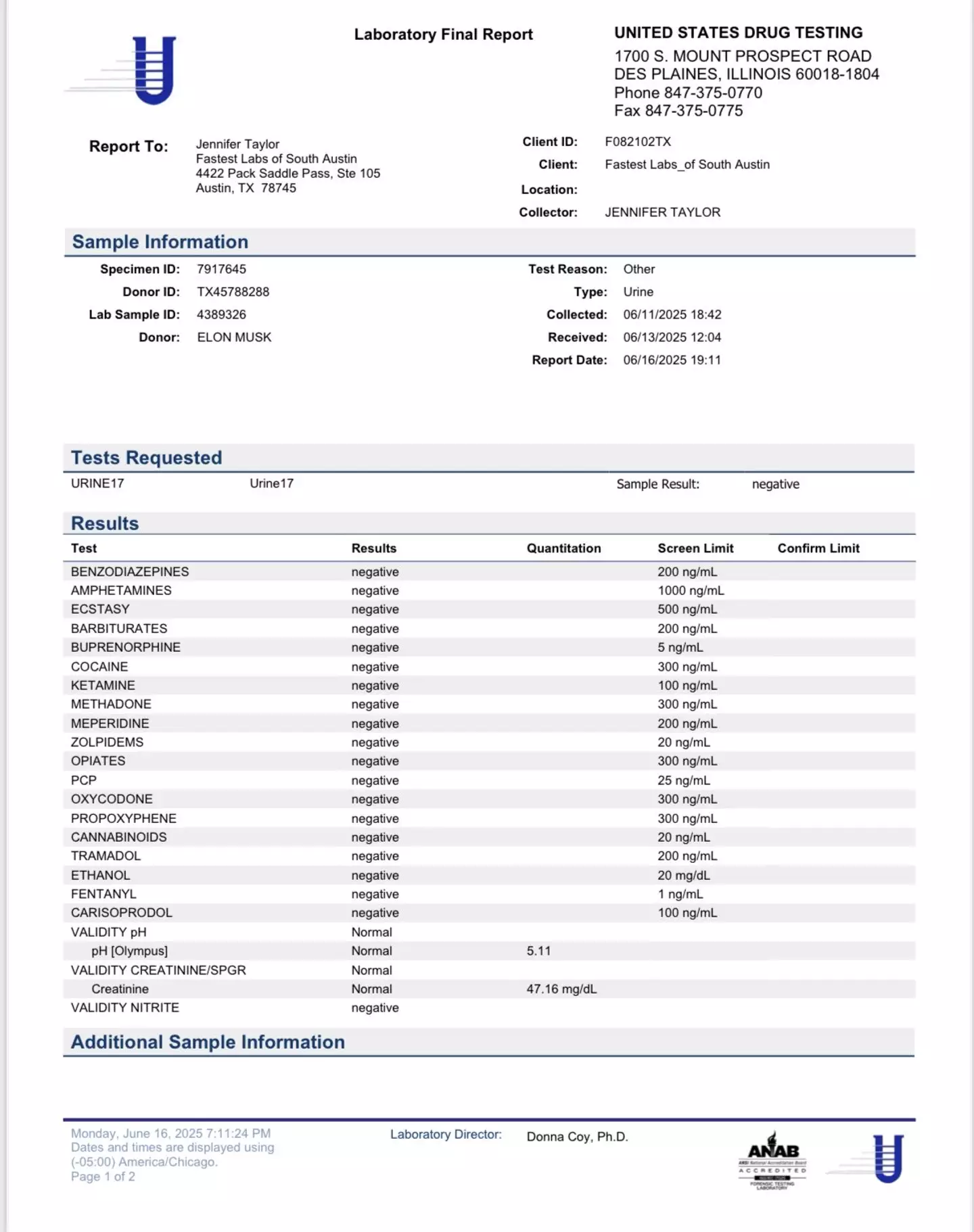Elon Musk has shut down drug abuse claims by revealing his negative test (x/elonmusk)