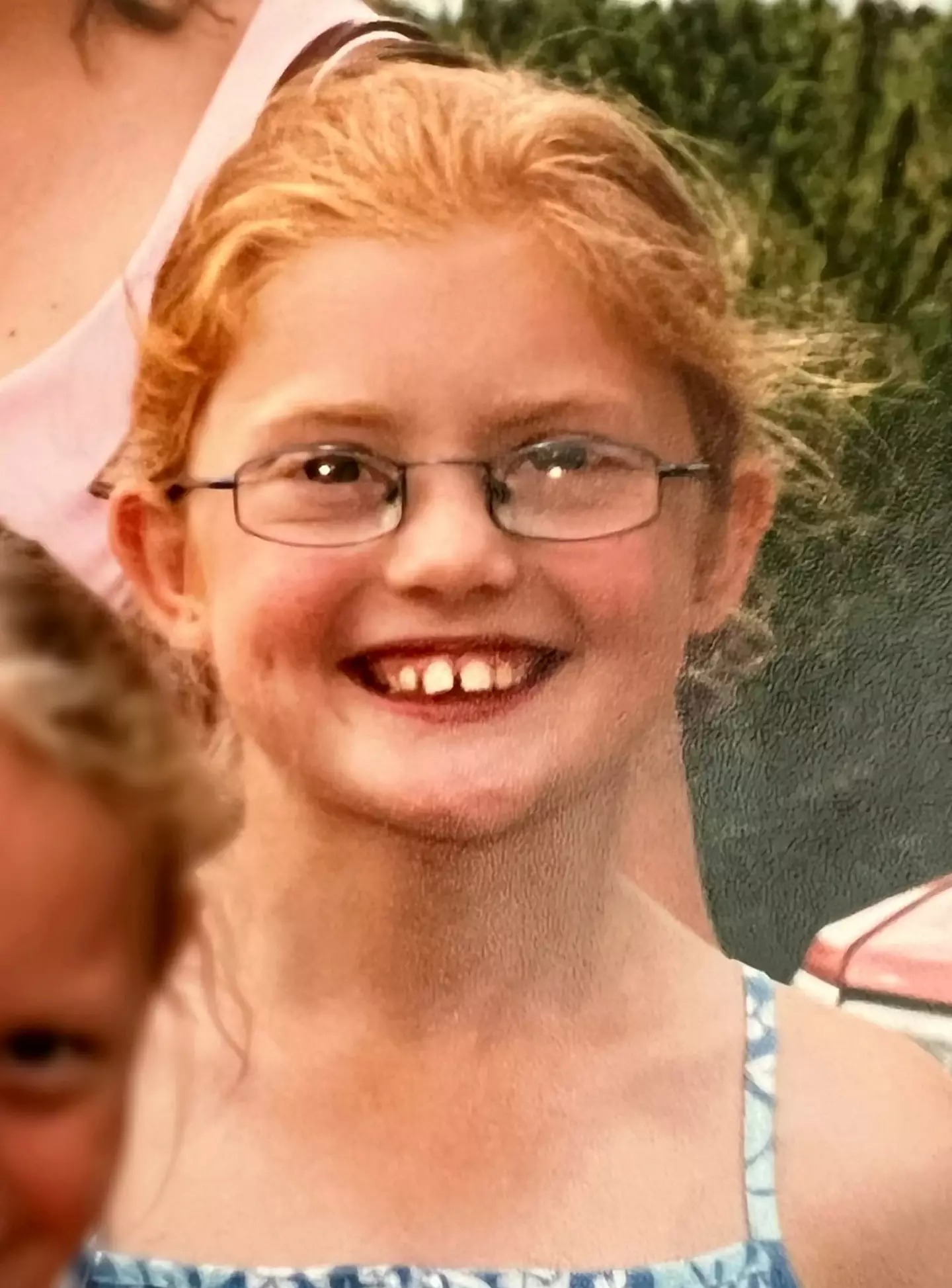 She was bullied in school because of her looks and her red hair.