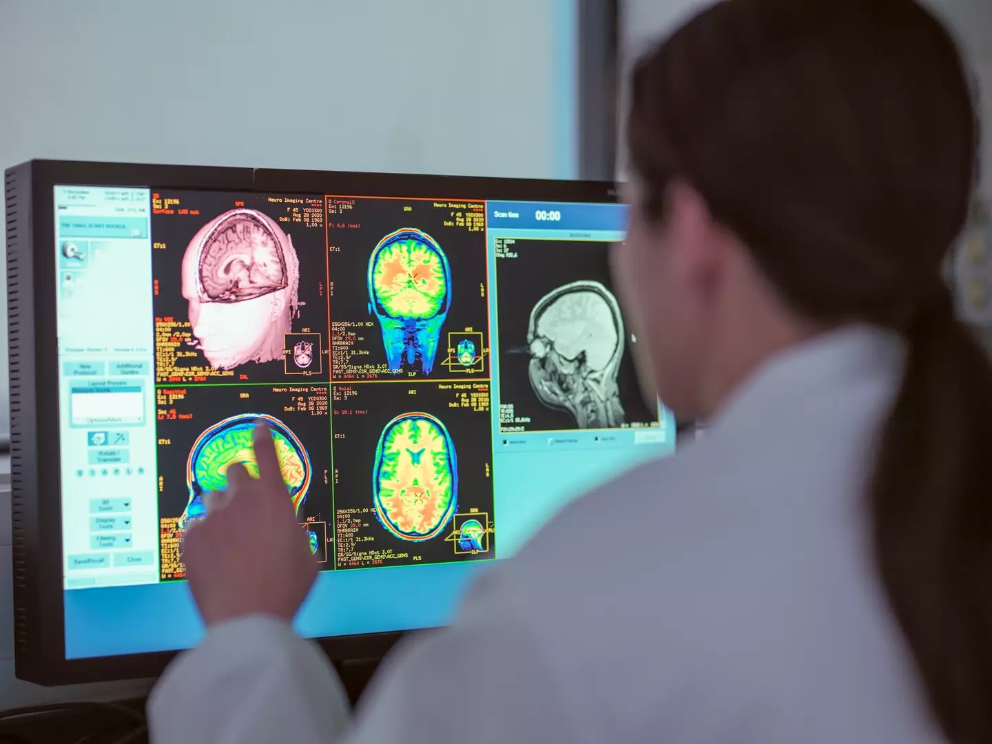 There are eight lifestyle factors to focus on to reduce the risk of strokes (Getty Stock)