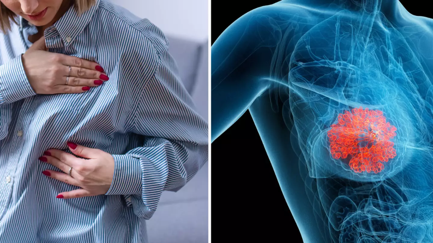 What it means if you have an ‘inverted nipple’ and when to seek medical help