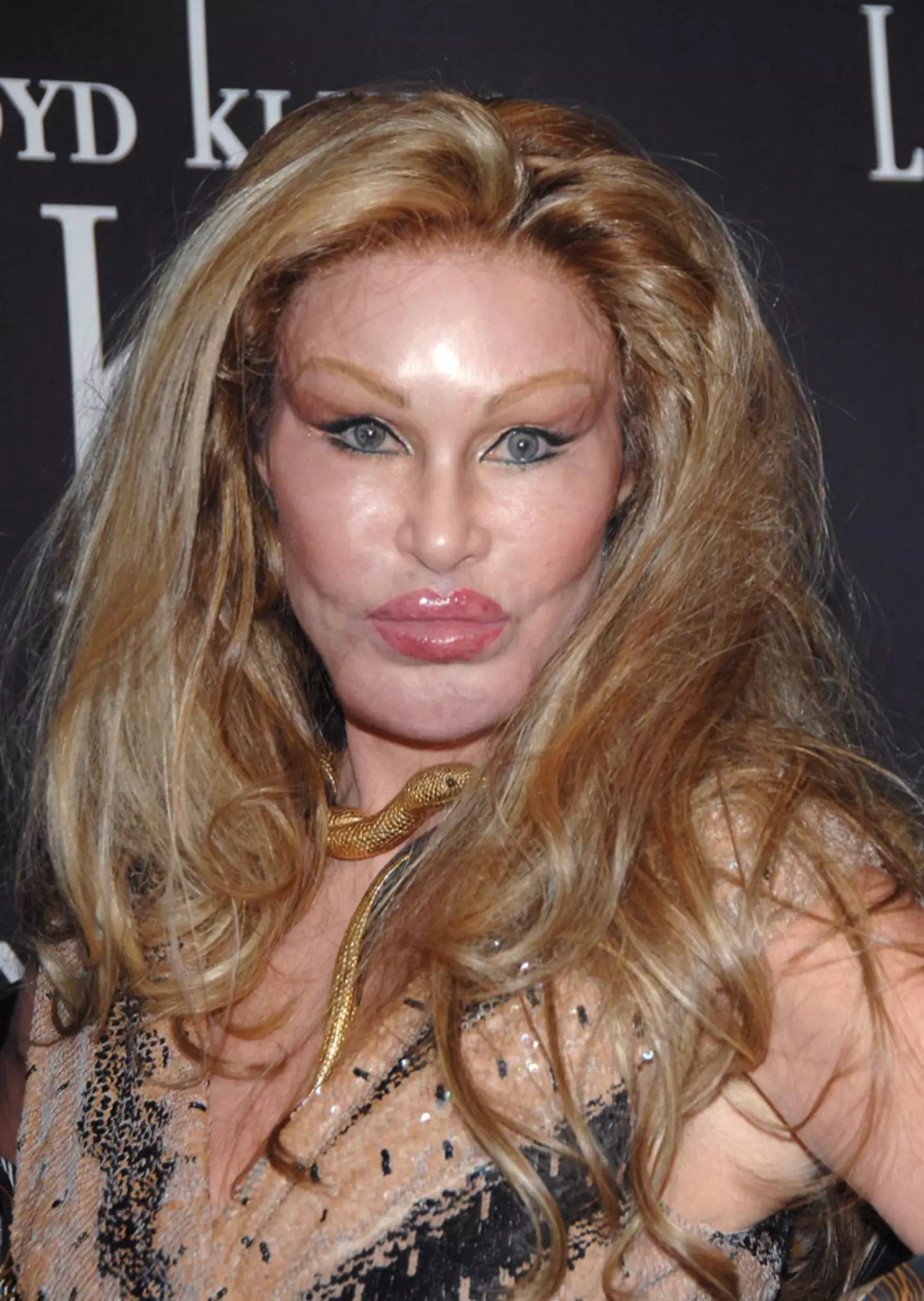 Many have asked whether Jocelyn Wildenstein has had cosmetic surgery.