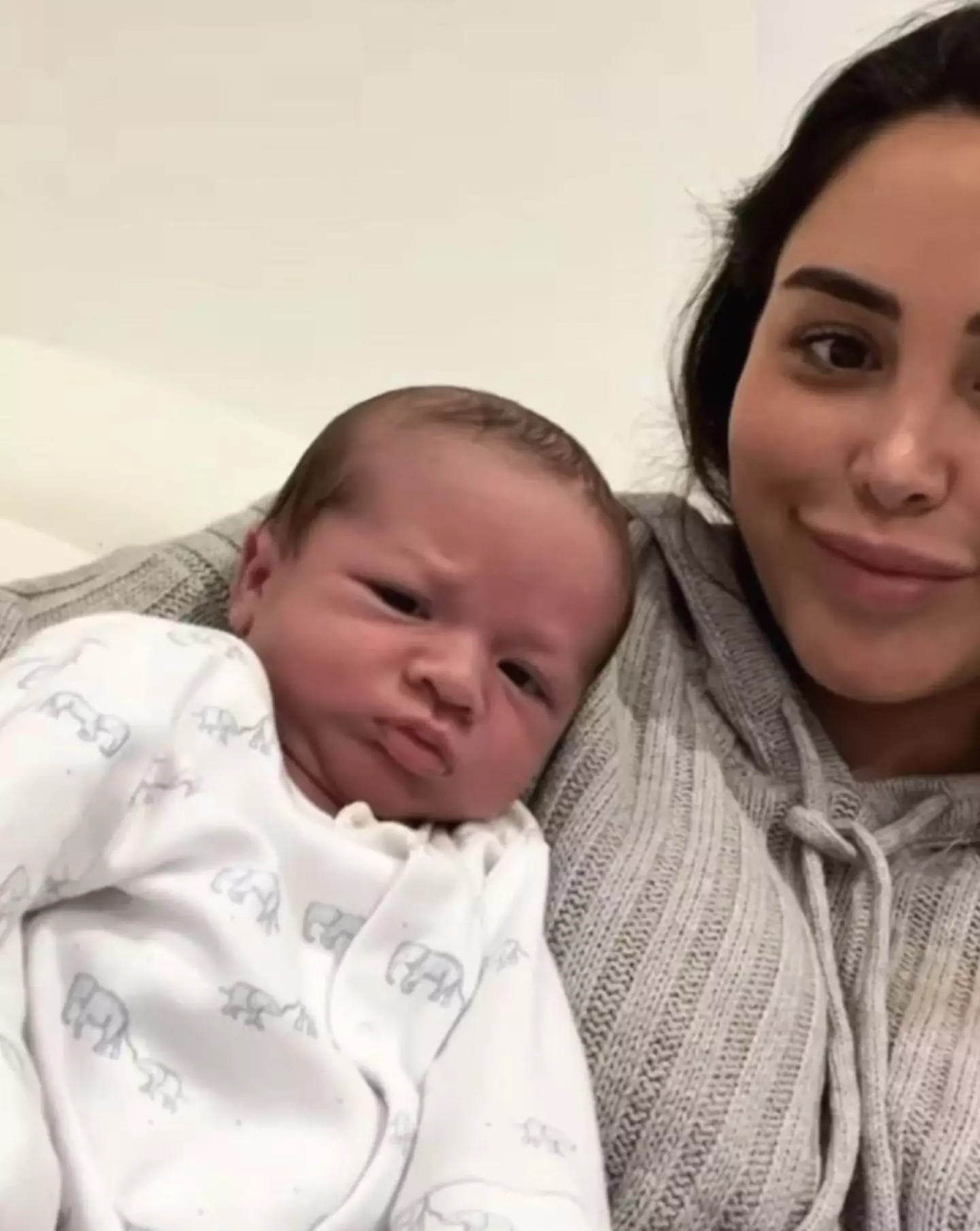 Marnie Simpson has opened up about her son's skull condition.