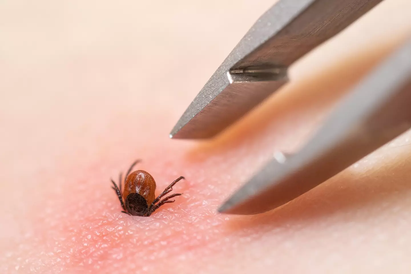 Lyme disease is spread by infected ticks (Getty Stock Image)