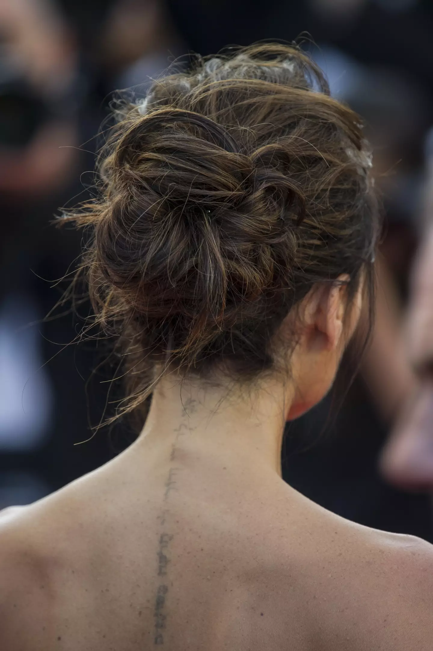 Victoria's back tattoo has also been removed.