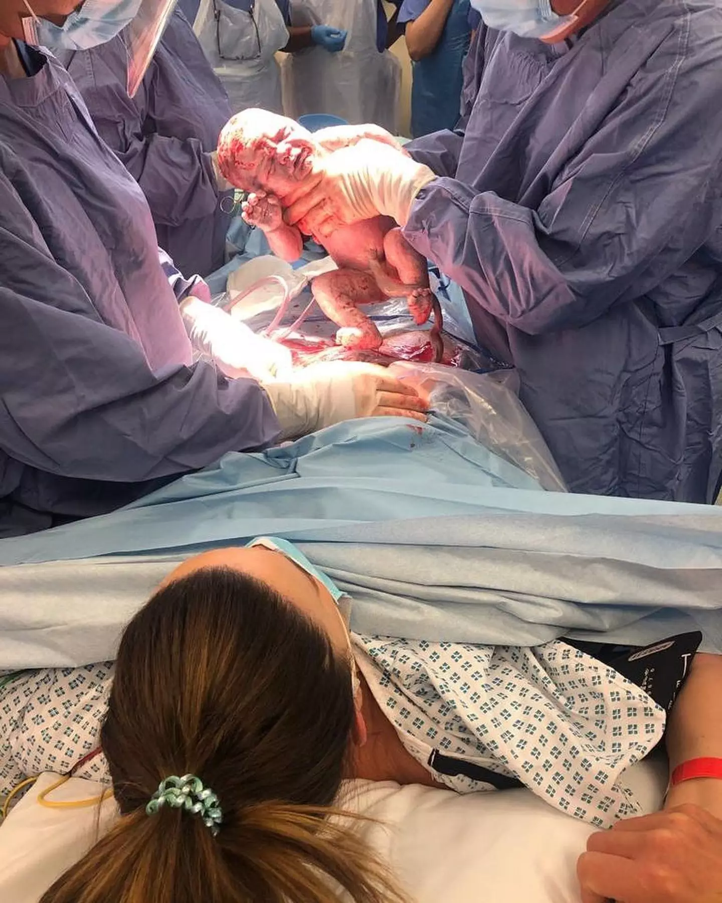 Maria Fowler shared pictures from her c-section on Instagram (