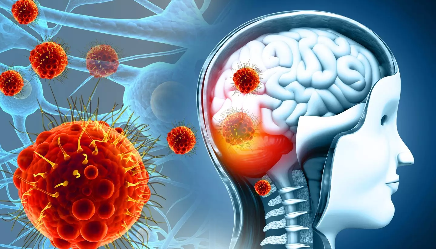 Nipah can cause a person's brain to swell (Getty Stock Image)