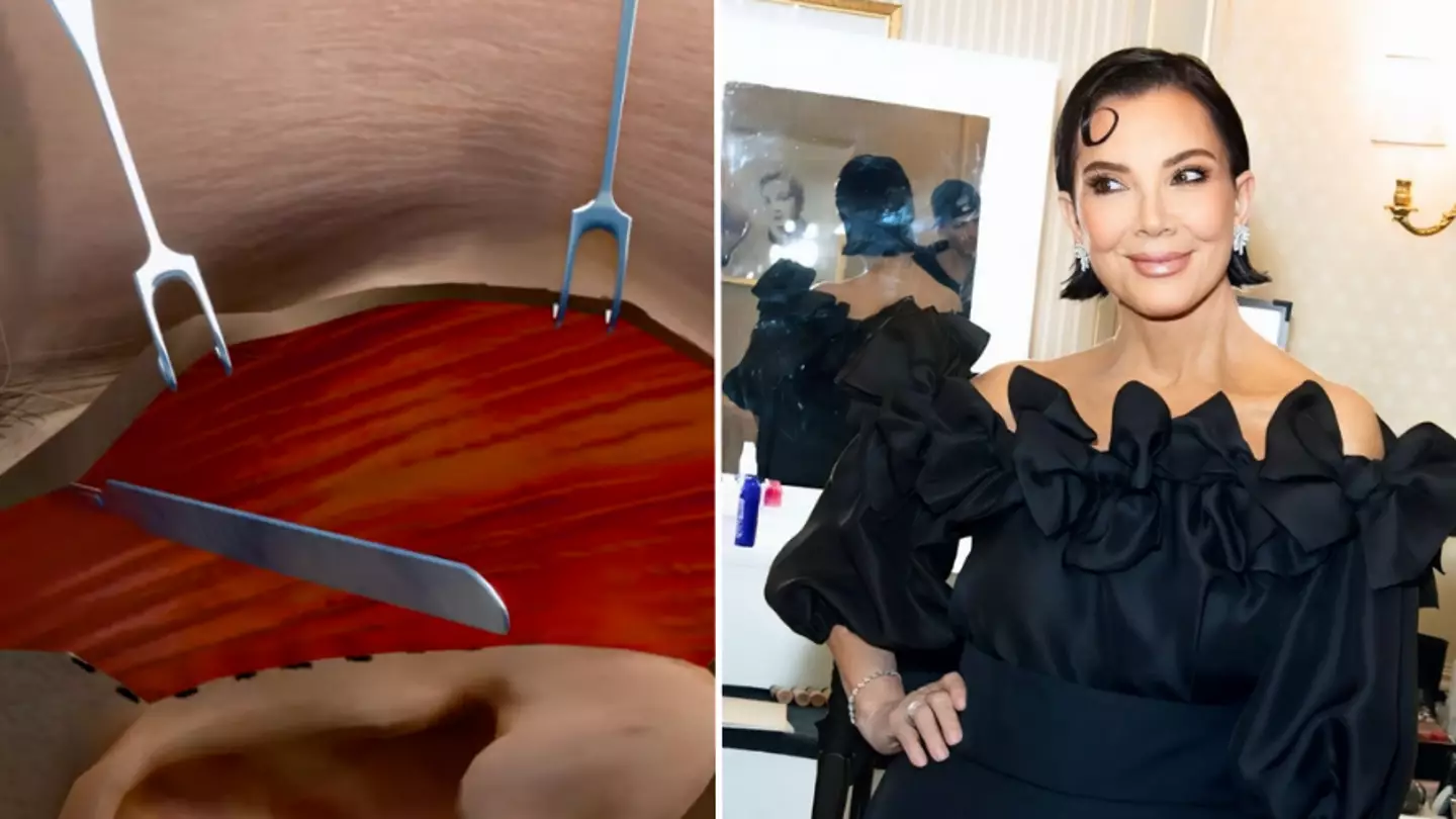 Gross animation shows how facelifts are done after Kris Jenner makes rare plastic surgery admission