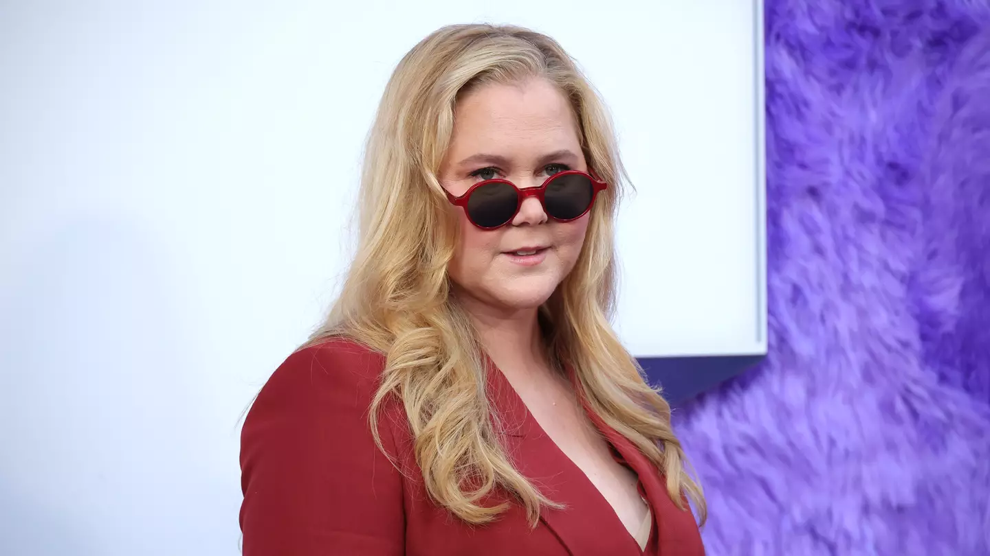 Amy Schumer’s little-known health condition explained after people’s online comments about her ‘moon face’ led to diagnosis