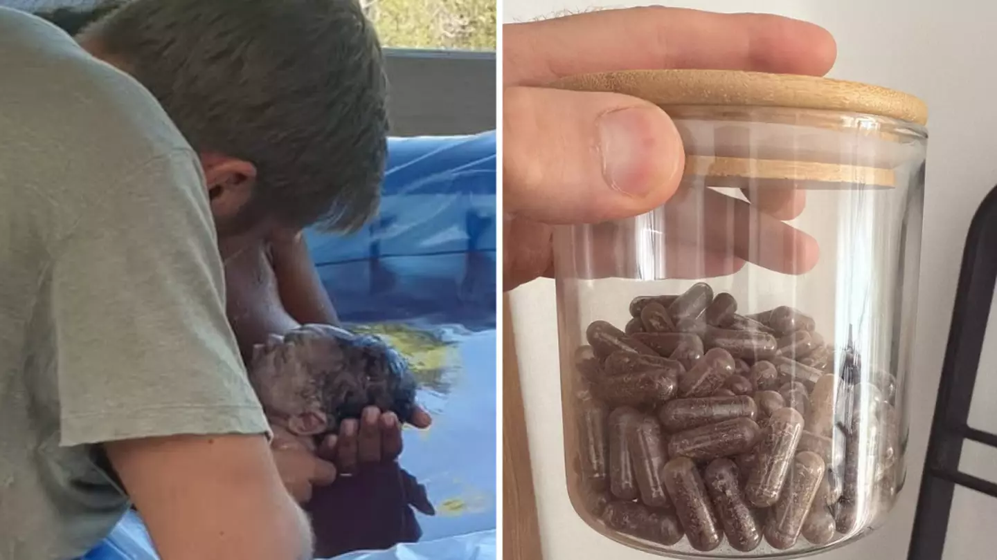 Doctor issues placenta warning after Calvin Harris' divisive new birthing photos spark debate