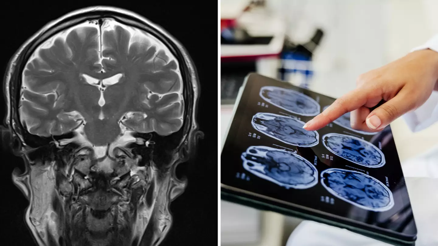 Scientist reveals there’s one ‘terrifying’ thing most people do to their brains