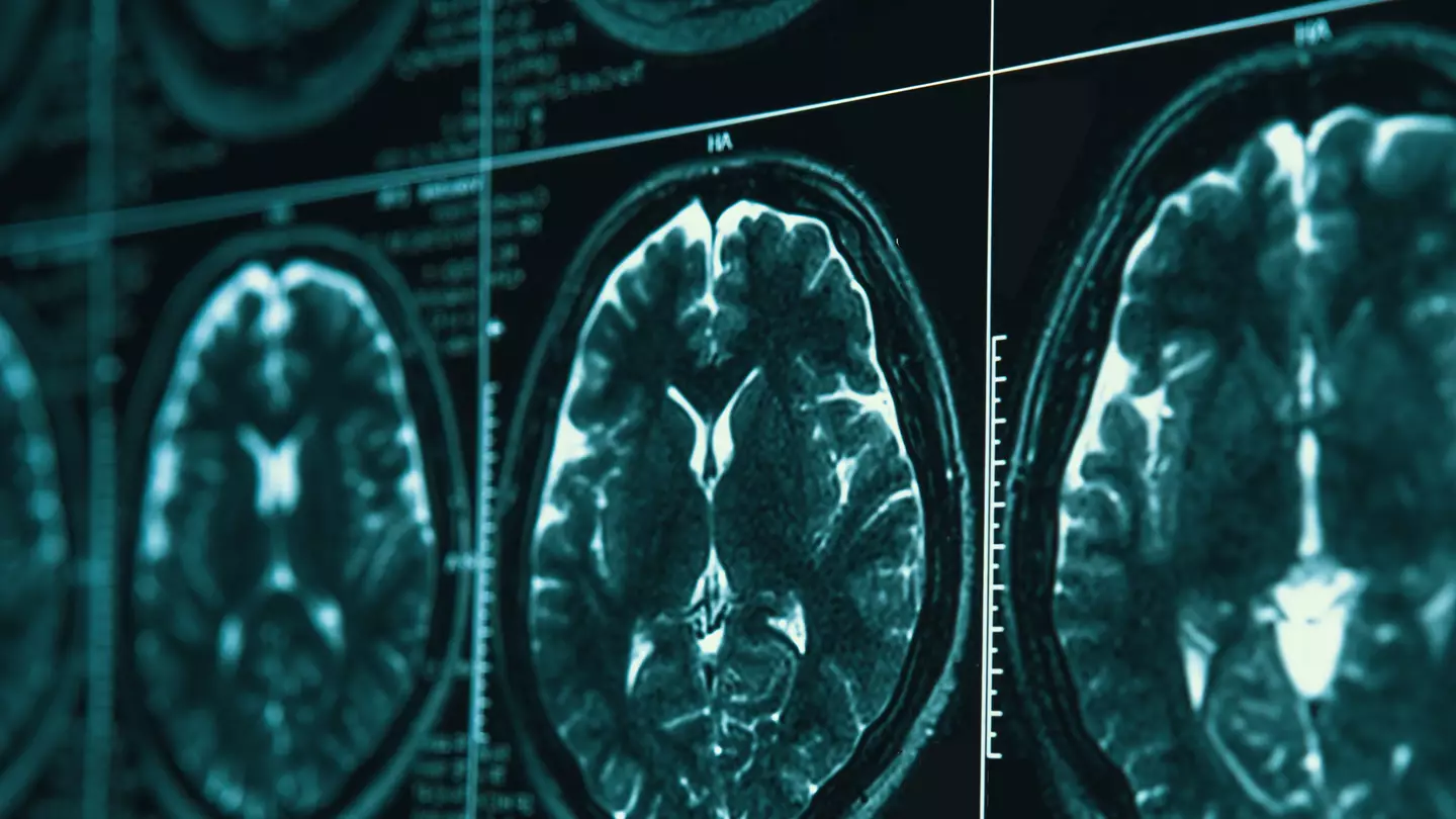 How your breathing could reveal early signs of Alzheimer’s disease