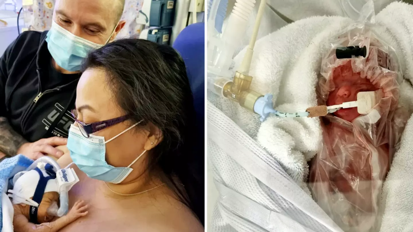 One Of Britain's Smallest Babies Survives After Being Put In Plastic Bag