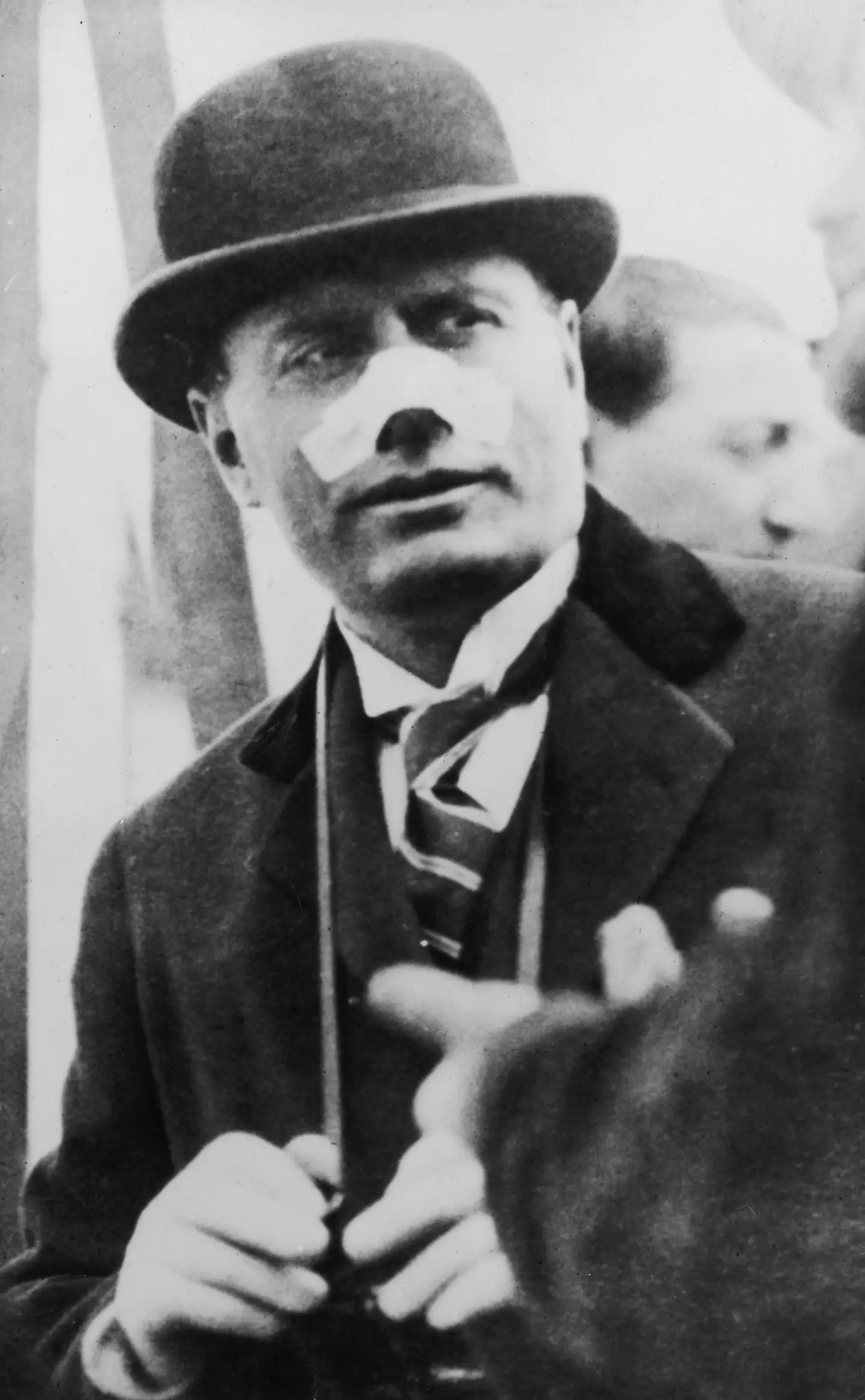 Mussolini after the failed assassination attempt (Topical Press Agency/Hulton Archive/Getty Images)