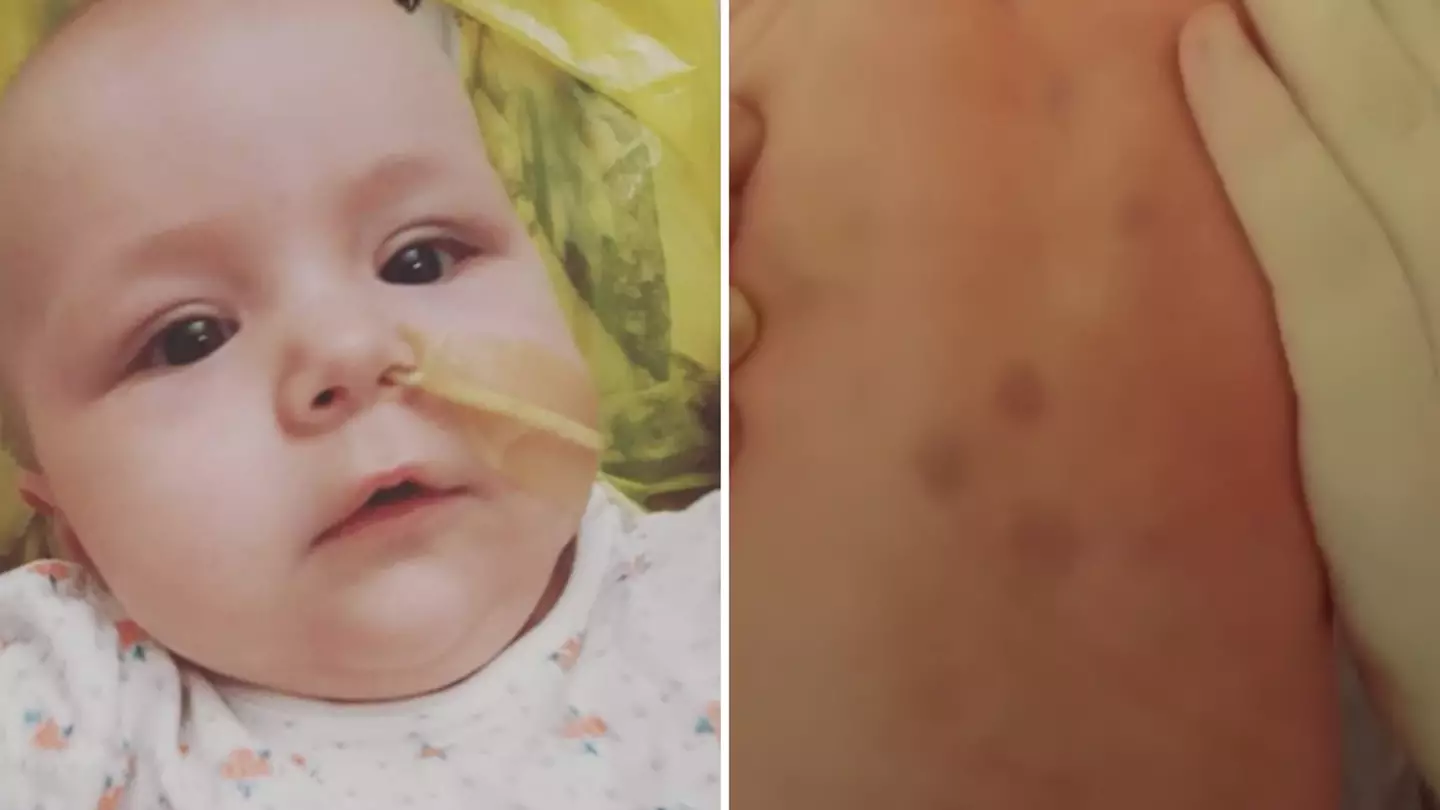 Parents given devastating diagnosis for newborn daughter after discovering rare purple spots on her body