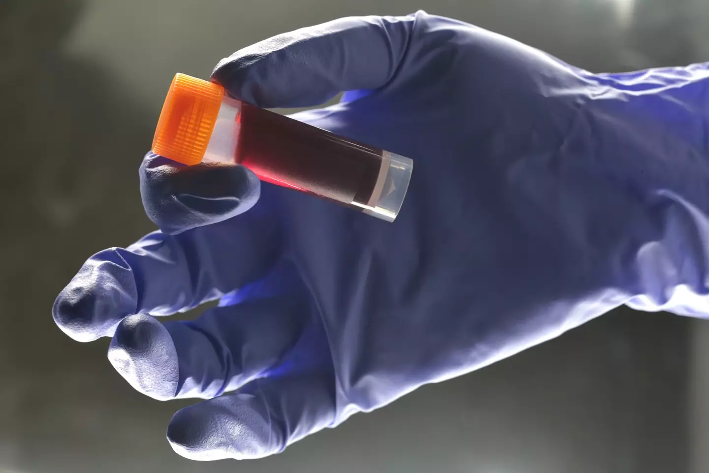 The ABO system classifies human blood into four main types based on the presence or absence of specific antigens (A and B) on red blood cells (Douglas Sacha / Getty Images)