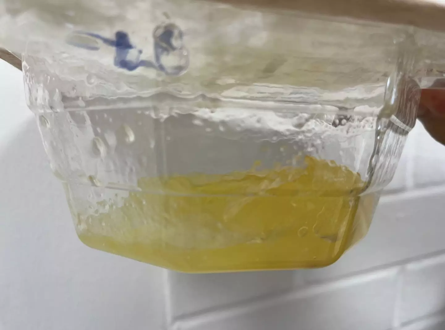 One of Gardiner's breast implants previously ruptured (Kennedy News and Media)