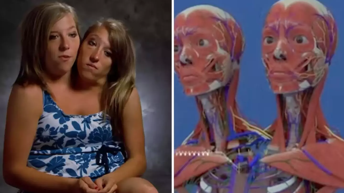 YouTube/OMGstories/TikTok/@abbyandbrittanyhensel