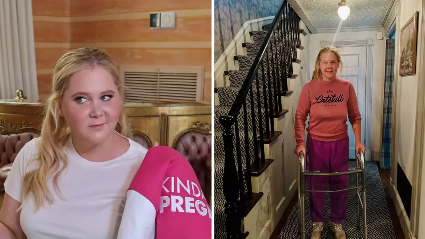 Amy Schumer admitted online comments about her ‘moon face’ led to health diagnosis