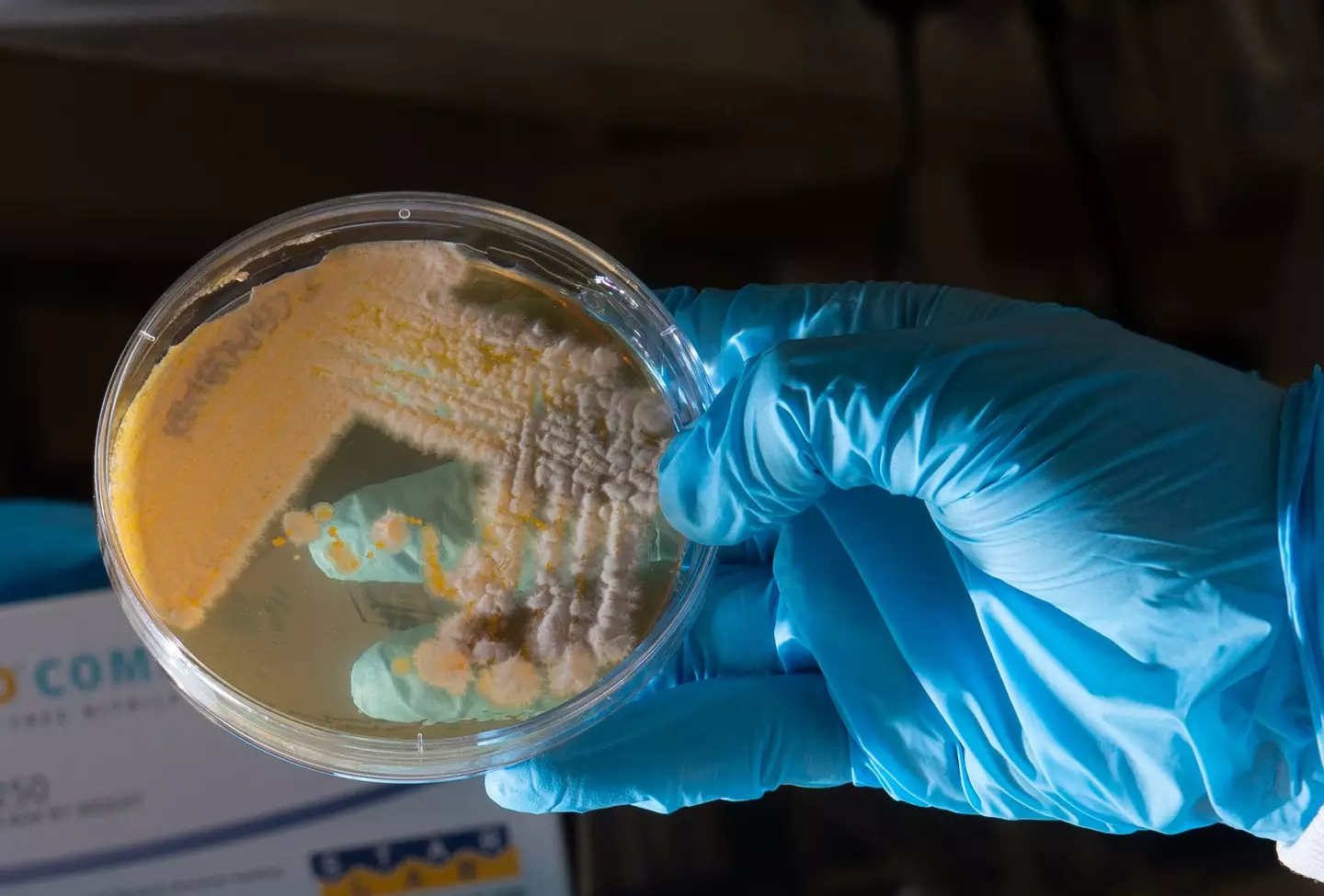 The self-checkout samples had one of the highest bacterial loads.