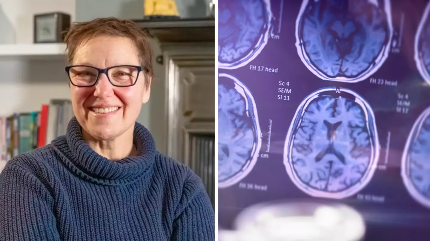 Woman who was diagnosed with Alzheimers in her 50s shares early signs to look out for