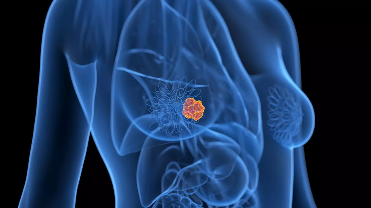 Breast Cancer Awareness Month kicked off on Tuesday (1 October) (Getty Stock Images)