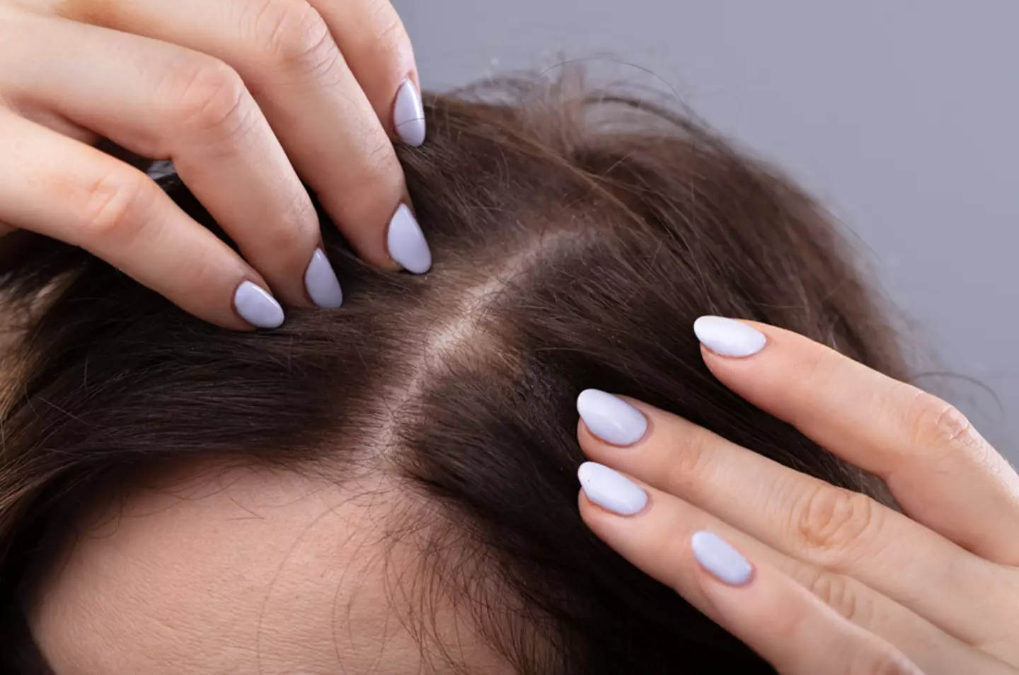 Side effects can be mild to moderate, or even severe - including hair loss (Getty Stock Images)