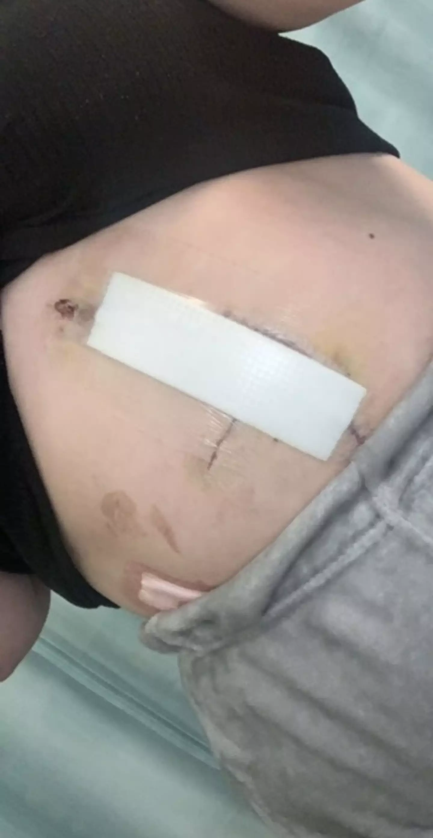 Bayliss will have to undergo further surgery (Kennedy News & Media)