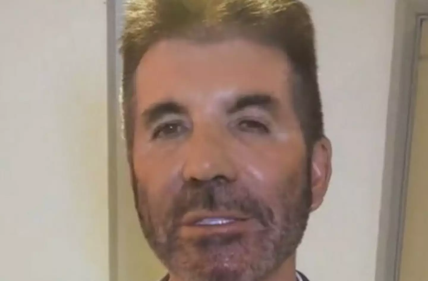 Simon Cowell got candid about cosmetic surgery back in 2022.