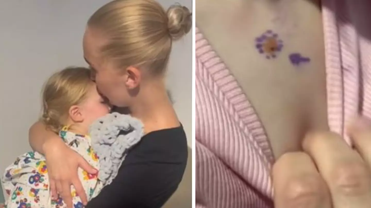 Mum's Warning After Getting Daughter's Birth Mark Removed