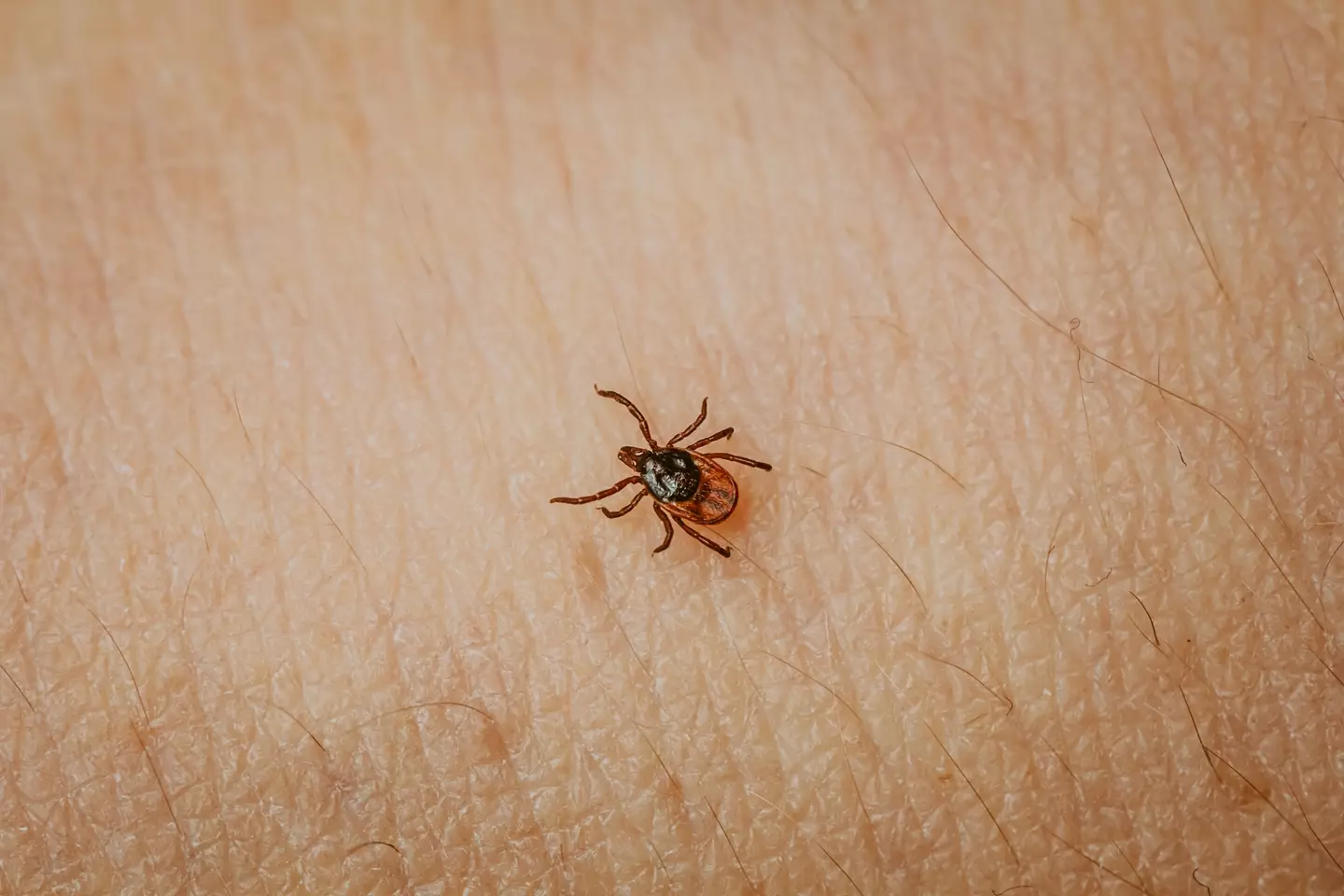The disease is contracted through a tick bite. (rbkomar/Getty)