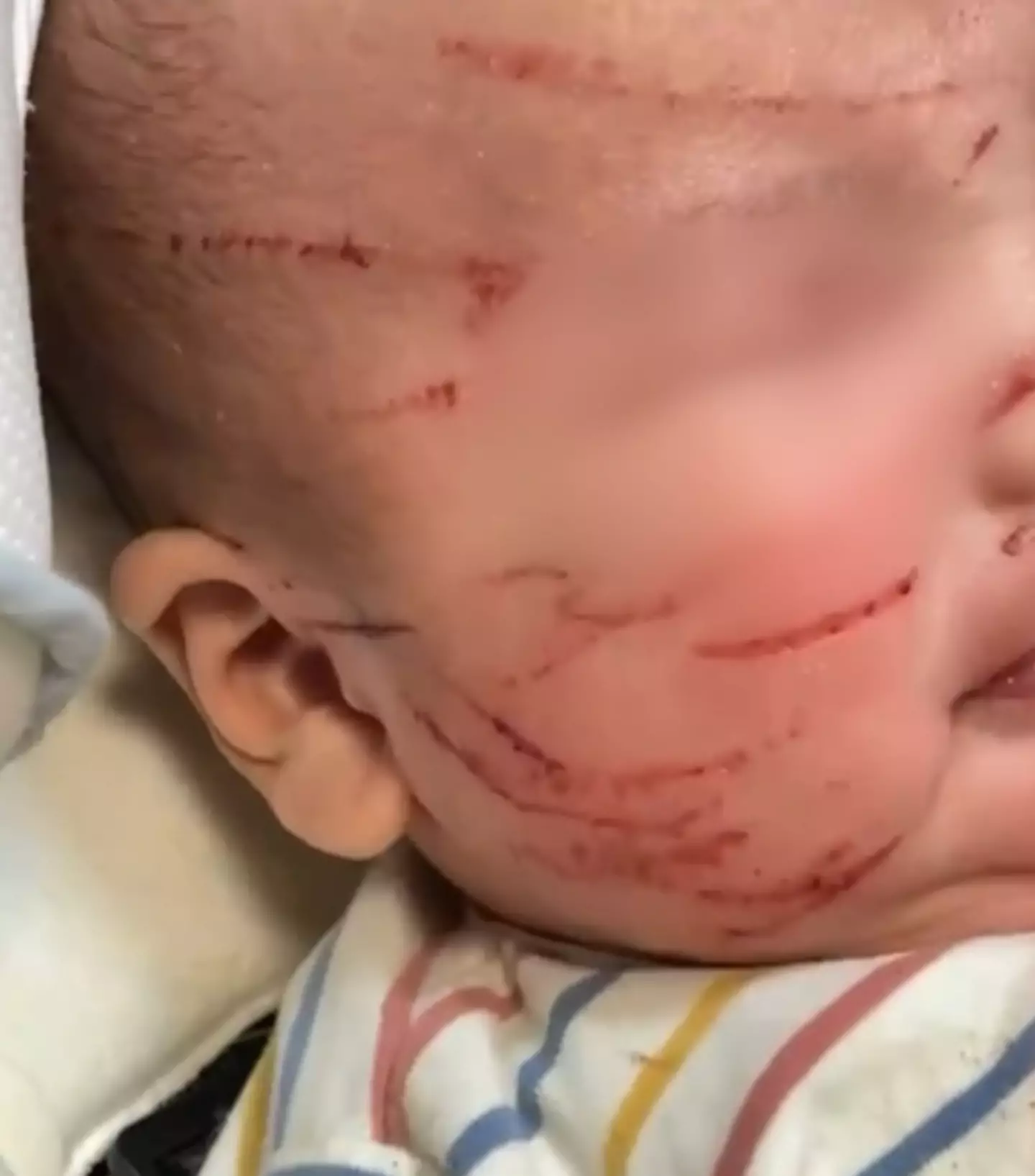 The baby's face has 'severe scratches'.